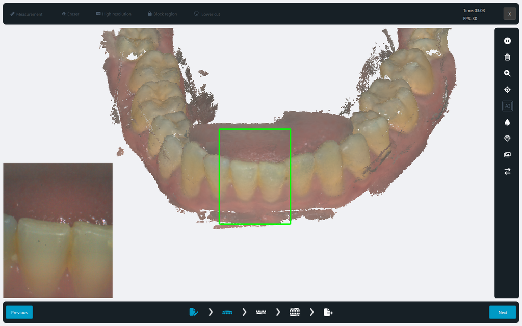 Scanner Intraoral Eagle Scan, Dabi Atlante - Imagen 2
