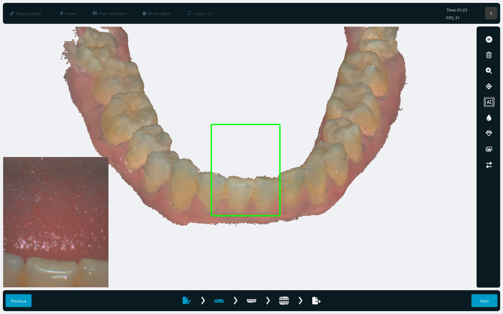 Scanner Intraoral Eagle Scan, Dabi Atlante - Imagen 3