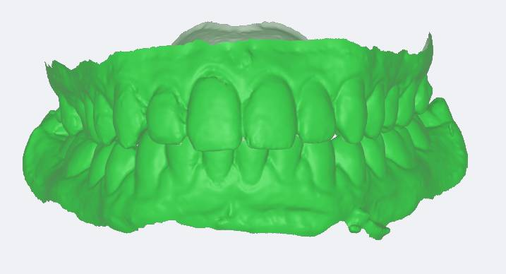 Scanner Intraoral Eagle Scan, Dabi Atlante - Imagen 5
