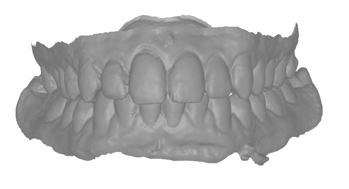 Scanner Intraoral Eagle Scan, Dabi Atlante - Imagen 6