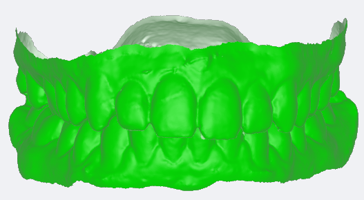 Scanner Intraoral Eagle Scan, Dabi Atlante - Imagen 7