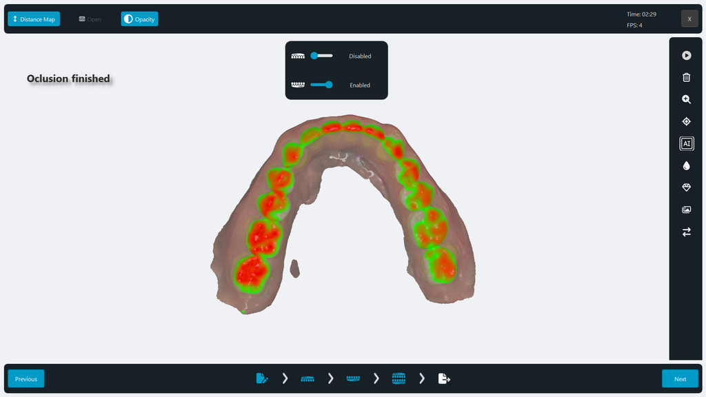 Scanner Intraoral Eagle Scan, Dabi Atlante - Imagen 8