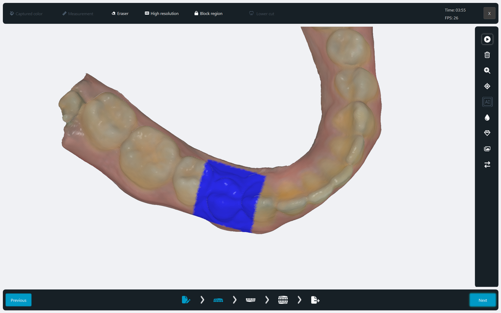 Scanner Intraoral Eagle Scan, Dabi Atlante - Imagen 9
