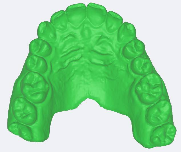 Scanner Intraoral Eagle Scan, Dabi Atlante - Imagen 11