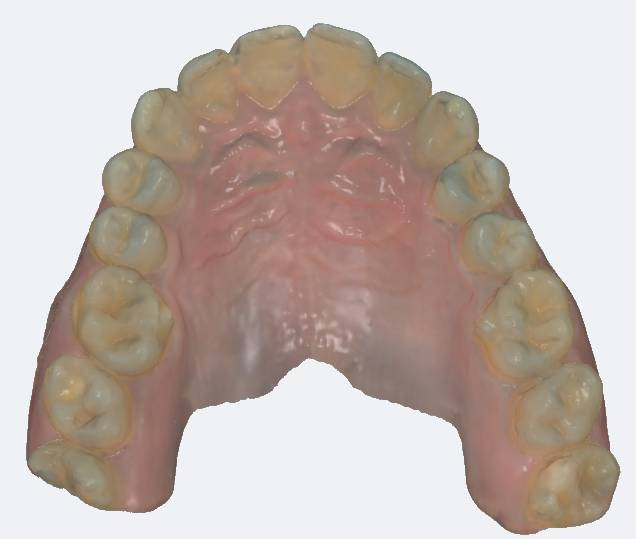 Scanner Intraoral Eagle Scan, Dabi Atlante - Imagen 10