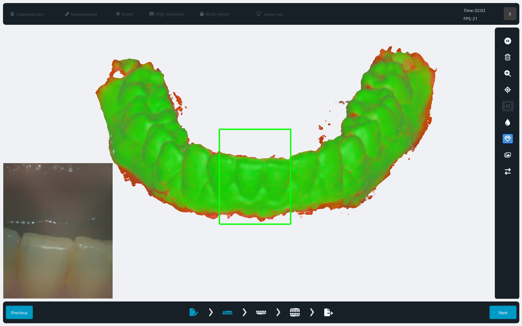 Scanner Intraoral Eagle Scan, Dabi Atlante - Imagen 12