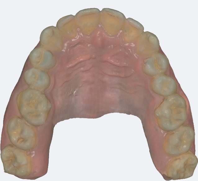 Scanner Intraoral Eagle Scan, Dabi Atlante - Imagen 13